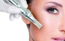 Microneedling treatments, Cosmetic procedures, lexinic.jpg