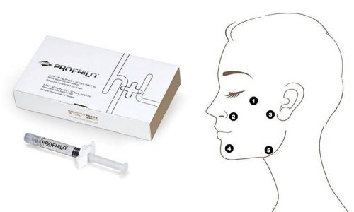 Profhilo,Lexinic Clinic.jpg